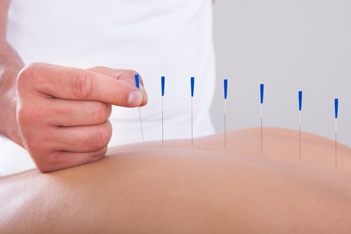 Acupuncture and Substance Abuse